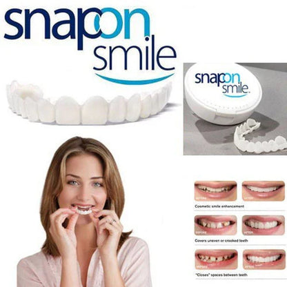 Snap On Smile – Lentille dentaire